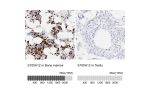 Immunohistochemistry analysis in human bone marrow and testis tissues using HPA002881 antibody. Corresponding S100A12 RNA-seq data are presented for the same tissues.