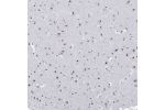 Immunohistochemistry analysis in human cerebral cortex and liver tissues using Anti-NPAS3 antibody. Corresponding NPAS3 RNA-seq data are presented for the same tissues.