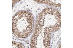 Immunohistochemical staining of human testis shows moderate nuclear and cytoplasmic positivity in cells in seminiferous ducts.