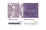 Immunohistochemistry analysis in human placenta and colon tissues using Anti-CDKN1C antibody. Corresponding CDKN1C RNA-seq data are presented for the same tissues.