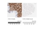 Immunohistochemistry analysis in human prostate and skeletal muscle tissues using HPA002925 antibody. Corresponding FLNA RNA-seq data are presented for the same tissues.
