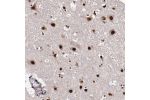 Immunohistochemical staining of human cerebral cortex shows strong nuclear and cytoplasmic positivity in neuronal cells.
