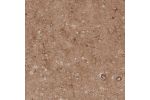 Immunohistochemical staining of human cerebral cortex shows moderate positivity in neuropil.