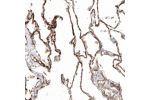 Immunohistochemical staining of human lung shows strong membranous positivity in pneumocytes and endothelial cells.