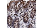 Immunohistochemical staining of human spleen shows strong cytoplasmic positivity in cells in red pulp.