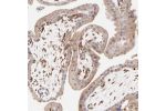 Immunohistochemical staining of human placenta shows strong positivity in endothelial cells and fibroblasts.