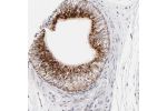 Immunohistochemical staining of human epididymis shows strong cytoplasmic positivity with granular pattern in glandular cells.