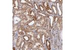 Immunohistochemical staining of human liver shows strong cytoplasmic positivity in hepatocytes.
