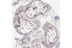 Immunohistochemical staining of human placenta shows moderate cytoplasmic positivity in fibroblasts.