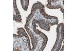 Immunohistochemical staining of human fallopian tube shows strong granular cytoplasmic positivity in glandular cells.