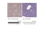 Immunohistochemistry analysis in human cerebral cortex and pancreas tissues using HPA003040 antibody. Corresponding MLC1 RNA-seq data are presented for the same tissues.