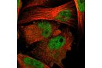 Immunofluorescent staining of human cell line U-251 MG shows localization to nucleoplasm.