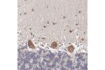 Immunohistochemical staining of human cerebral cortex shows strong cytoplasmic positivity in neurons.