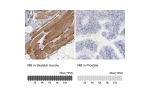 Immunohistochemistry analysis in human skeletal muscle and prostate tissues using Anti-MB antibody. Corresponding MB RNA-seq data are presented for the same tissues.