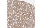 Immunohistochemical staining of human liver shows moderate granular cytoplasmic positivity in hepatocytes.