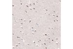 Immunohistochemical staining of human hippocampus shows cytoplasmic positivity in neuronal cells.