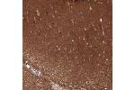 Immunohistochemical staining of human cerebral cortex shows moderate cytoplasmic/ membranous positivity in neurons and moderately stained neuropil.