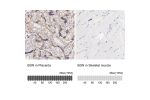 Immunohistochemistry analysis in human placenta and skeletal muscle tissues using HPA003157 antibody. Corresponding BGN RNA-seq data are presented for the same tissues.