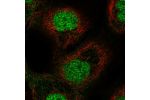 Immunofluorescent staining of human cell line A-431 shows localization to nucleoplasm.