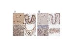 Immunohistochemical staining of human cerebral cortex, colon, spleen and testis using Anti-MED12 antibody HPA003184 (A) shows similar protein distribution across tissues to independent antibody HPA003185 (B).
