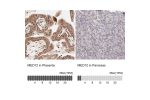 Immunohistochemistry analysis in human placenta and pancreas tissues using Anti-MED12 antibody. Corresponding MED12 RNA-seq data are presented for the same tissues.