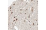 Immunohistochemical staining of human cerebral cortex shows moderate cytoplasmic positivity in neurons.