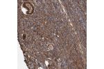 Immunohistochemical staining of human Ovary shows strong positivity in extracellular matrix in follicle cells and stromal cells.