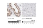Immunohistochemistry analysis in human testis and skeletal muscle tissues using Anti-CCT2 antibody. Corresponding CCT2 RNA-seq data are presented for the same tissues.