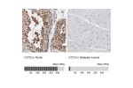 Immunohistochemistry analysis in human testis and skeletal muscle tissues using Anti-CCT2 antibody. Corresponding CCT2 RNA-seq data are presented for the same tissues.