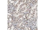 Immunohistochemical staining of human kidney shows nuclear positivity in cells in tubules and cells in glomeruli.