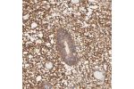 Immunohistochemical staining of human endometrium shows strong membranous positivity in stromal cells.