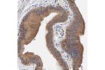 Immunohistochemical staining of human gall bladder shows cytoplasmic positivity in glandular cells.