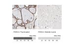 Immunohistochemistry analysis in human thyroid gland and skeletal muscle tissues using HPA003230 antibody. Corresponding PDIA3 RNA-seq data are presented for the same tissues.