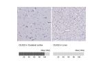 Immunohistochemistry analysis in human cerebral cortex and liver tissues using HPA003254 antibody. Corresponding OLIG2 RNA-seq data are presented for the same tissues.