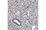 Immunohistochemical staining of human endometrium shows moderate nuclear positivity in glandular and stromal cells.