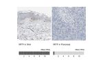 Immunohistochemistry analysis in human skin and pancreas tissues using HPA003259 antibody. Corresponding MITF RNA-seq data are presented for the same tissues.