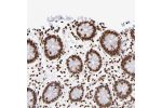 Immunohistochemical staining of human colon shows strong nuclear positivity in glandular cells.