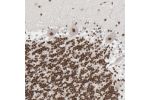 Immunohistochemical staining of human cerebellum shows strong nuclear positivity in all layers.