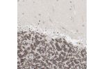 Immunohistochemical staining of human cerebellum shows moderate nuclear positivity in cells in granular layer.