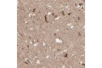 Immunohistochemical staining of human cerebral cortex shows moderate cytoplasmic positivity in neuronal cells.