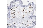 Immunohistochemical staining of human placenta shows strong cytoplasmic positivity in Hofbauer cells.