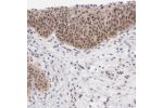 Immunohistochemical staining of human urinary bladder shows moderate nuclear and cytoplasmic positivity in urothelial cells.
