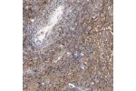 Immunohistochemistry analysis in human ovary and cerebral cortex tissues using Anti-DCN antibody. Corresponding DCN RNA-seq data are presented for the same tissues.