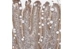 Immunohistochemical staining of human duodenum shows strong granular cytoplasmic positivity in glandular cells.