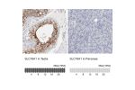 Immunohistochemistry analysis in human testis and pancreas tissues using HPA003324 antibody. Corresponding SLC16A1 RNA-seq data are presented for the same tissues.