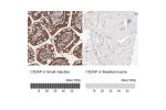 Immunohistochemistry analysis in human small intestine and skeletal muscle tissues using HPA003326 antibody. Corresponding CD2AP RNA-seq data are presented for the same tissues.