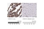 Immunohistochemistry analysis in human lung and skeletal muscle tissues using HPA003340 antibody. Corresponding S100A10 RNA-seq data are presented for the same tissues.
