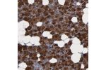 Immunohistochemical staining of human salivary gland shows strong cytoplasmic positivity in glandular cells.