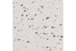 Immunohistochemical staining of human cerebral cortex shows moderate cytoplasmic positivity in neurons.