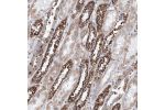 Immunohistochemical staining of human kidney shows strong cytoplasmic positivity in distal tubules.
